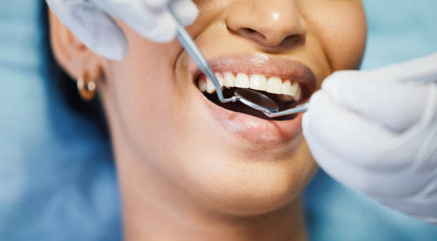 Best Emergency Dental Filling Replacement  in East Troy, WI