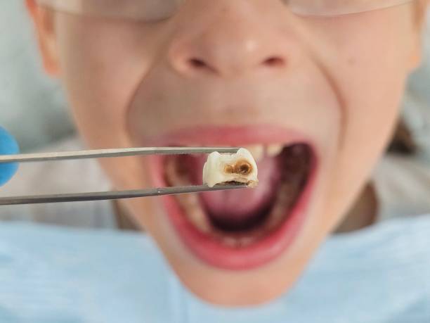 Best Emergency Gum Pain Relief  in East Troy, WI